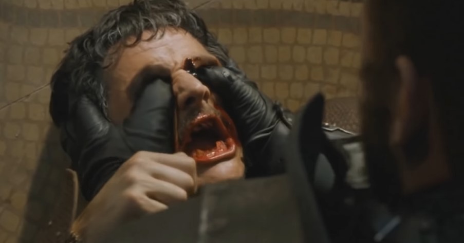 Pedro Pascal Got an Eye Infection from Posing with Game of Thrones Fans